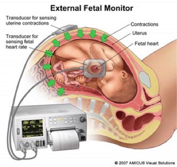 External-Fetal-Monitor Cardiotocografia Fetal - ClinicC Dr. Rui Coimbra