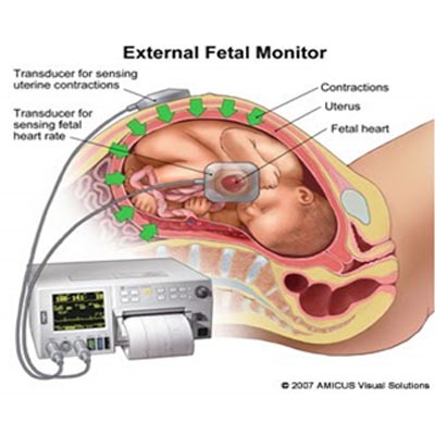 Cardiotocografia Fetal - ClinicC Dr. Rui Coimbra